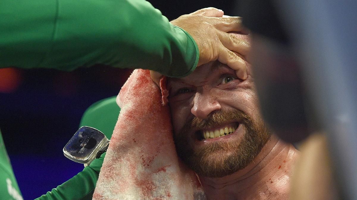 Усик Ф'юрі 2 - Тайсон видав гучну заяву про свою перемогу нокаутом у реванші Усик Ф'юрі 2 - Тайсон видав гучну заяву про свою перемогу нокаутом у реванші