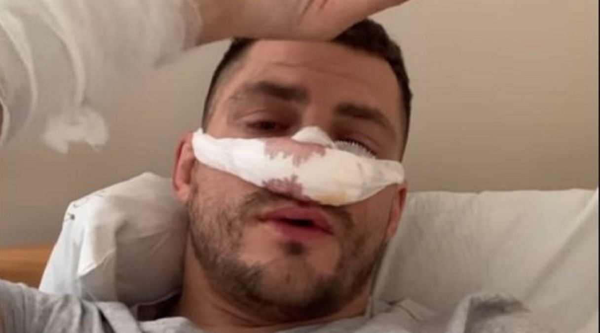 Денис Беринчик сделал операцию на носу - видео последствий боя с Кейшоном Дэвисом Денис Беринчик сделал операцию на носу - видео последствий боя с Кейшоном Дэвисом